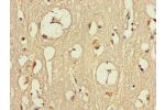 Immunohistochemistry of paraffin-embedded human brain tissue using CSB-PA819469LA01HU at dilution of 1:100