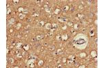 Immunohistochemistry of paraffin-embedded human brain tissue using CSB-PA819472LA01HU at dilution of 1:100