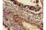 Immunohistochemistry of paraffin-embedded human lung tissue using CSB-PA819476LA01HU at dilution of 1:100