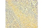 Immunohistochemistry of paraffin-embedded human tonsil tissue using CSB-PA819483LA01HU at dilution of 1:100