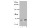 Western blot<br />
All lanes: N6AMT2 antibody at 10ug/ml<br />
Lane 1 : Jurkat whole cell lysate<br />
Lane 2 : K562 whole cell lysate<br />
Secondary<br />
Goat polyclonal to Rabbit IgG at 1/10000 dilution<br />
Predicted band size: 24 kDa<br />
Observed