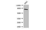 Western Blot<br />
Positive WB detected in:K562 whole cell lysate<br />
All lanes: CPT1B antibody at 3.4ug/ml<br />
Secondary<br />
Goat polyclonal to rabbit IgG at 1/50000 dilution<br />
Predicted band size: 88,67,84,79 kDa<br />
Observed band size: 88 k