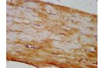 IHC image of CSB-PA821705LA01HU diluted at 1:400 and staining in paraffin-embedded human skeletal muscle tissue performed on a Leica BondTM system. After dewaxing and hydration, antigen retrieval was mediated by high pressure in a citrate buffer (pH 6.0).