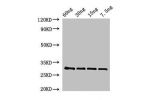 Western Blot<br />
Positive WB detected in Recombinant protein<br />
All lanes:BAS1 antibody at 2.5