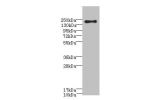 Western blot<br />
All lanes: CR1antibody IgG at 3.15ug/ml+ 293T whole cell lysate<br />
Secondary<br />
Goat polyclonal to rabbit IgG at 1/10000 dilution<br />
Predicted band size: 224 kDa<br />
Observed band size: 224 kDa<br />