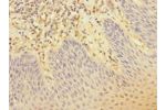 Immunohistochemistry of paraffin-embedded human tonsil tissue CSB-PA822164ESR2HU at dilution 1:100