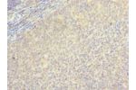 Immunohistochemistry of paraffin-embedded human tonsil tissue using CSB-PA822164LA01HU at dilution of 1:100