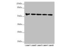 Western blot<br />
All lanes: FOXRED1 antibody at 5.8 ug/ml<br />
Lane 1 : A549 whole cell lysate<br />
Lane 2 : A431 whole cell lysate<br />
Lane 3 : Jurkat whole cell lysate<br />
Lane 4 : Hela whole cell lysate<br />
Lane 5 : HepG-2 whole cell lysate<b