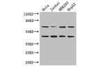 Western Blot<br />
Positive WB detected in:Hela whole cell lysate,Jurkat whole cell lysate,HEK293 whole cell lysate,HepG2 whole cell lysate<br />
All lanes: DAZAP1 antibody at 2.8ug/ml<br />
Secondary<br />
Goat polyclonal to rabbit IgG at 1/50000 dilutio