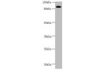 Western blot<br />
All lanes:CEP95 antibody at 2.67 ug/ml+ Mouse heart tissue<br />
Secondary<br />
Goat polyclonal to rabbit IgG at 1/10000 dilution<br />
Predicted band size: 96,77 kDa<br />
Observed band size: 95 kDa<br />