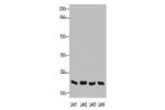 Western blot<br />
All lanes: C5orf45 antibody at 4ug/ml<br />
Lane 1 : Mouse liver tissue<br />
Lane 2 : Mouse kidney tissue<br />
Lane 3 : Mouse lung tissue<br />
Lane 4 : Mouse heart tissue<br />
 Goat polyclonal to Rabbit IgG at 1/10000 dilution<br />