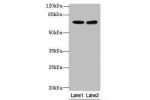 Western blot<br />
All lanes: GALNT15 antibody at 5ug/ml<br />
Lane 1 : Mouse kidney tissue<br />
Lane 2 : Mouse liver tissue<br />
Secondary<br />
Goat polyclonal to Rabbit IgG at 1/10000 dilution<br />
Predicted band size: 73 kDa<br />
Observed band siz