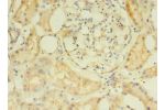 Immunohistochemistry of paraffin-embedded human kidney tissue using CSB-PA822731LA01HU at dilution of 1:100