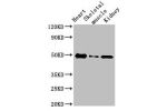 Western Blot<br />
Positive WB detected in:Rat heart tissue,Rat skeletal muscle,Mouse kidney tissue<br />
All lanes:ATP6V1C2 antibody at 3.4