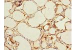 Immunohistochemistry of paraffin-embedded human thyroid tissue using CSB-PA822782ESR2HU at dilution 1:100