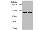 Western blot<br />
All lanes: DBF4B antibody at 4ug/ml<br />
Lane 1 : MCF7 whole cell lysate<br />
Lane 2 : A549 whole cell lysate<br />
Secondary<br />
Goat polyclonal to Rabbit IgG at 1/10000 dilution<br />
Predicted band size: 68,48,55,19 kDa<br />
Obs
