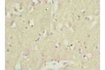 Immunohistochemistry of paraffin-embedded human brain tissue using CSB-PA822822LA01HU at dilution of 1:100