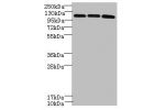 Western blot<br />
All lanes: DIS3L antibody at 6ug/ml<br />
Lane 1 : Hela whole cell lysate<br />
Lane 2 : HepG-2 whole cell lysate<br />
Lane 3 : MCF7 whole cell lysate<br />
Secondary<br />
Goat polyclonal to Rabbit IgG at 1/10000 dilution<br />
Predic