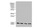 Western blot<br />
All lanes: C2orf15 antibody at 6ug/ml<br />
Lane 1 : U251 whole cell lysate<br />
Lane 2 : MCF7 whole cell lysate<br />
Lane 3 : HCT116 whole cell lysate<br />
Secondary<br />
Goat polyclonal to Rabbit IgG at 1/10000 dilution<br />
Pred