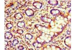 Immunohistochemistry of paraffin-embedded human small intestine using CSB-PA823892HA01HU at dilution 1:100