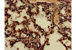 Immunohistochemistry of paraffin-embedded human lung tissue using CSB-PA823894LA01HU at dilution of 1:100