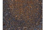 The image on the left is immunohistochemistry of paraffin-embedded Human tonsil tissue using CSB-PA827389(ANXA2R Antibody) at dilution 1/25, on the right is treated with synthetic peptide. (Original magnification: 
