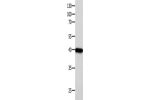 Gel: 10%SDS-PAGE, Lysate: 40 