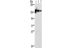 Gel: 6%SDS-PAGE, Lysate: 40 