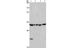 Gel: 8%SDS-PAGE,Lysate: 40 