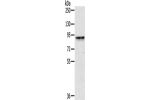 Gel: 6%SDS-PAGE, Lysate: 40 