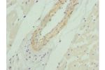 Immunohistochemistry of paraffin-embedded human heart tissue using CSB-PA836185DSR2HU at dilution 1:100
