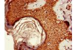 Immunohistochemistry of paraffin-embedded human skin tissue using CSB-PA836185LA01HU at dilution of 1:100