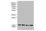 Western blot<br />
All lanes: FAM136A antibody at 8ug/ml<br />
Lane 1 : U251 whole cell lysate<br />
Lane 2 : Hela whole cell lysate<br />
Lane 3 : MCF7 whole cell lysate<br />
Lane 4 : A549 whole cell lysate<br />
Lane 5 : Caco-2 whole cell lysate<br />
