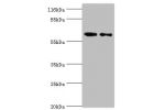 Western blot<br />
All lanes:Polypeptide N-acetylgalactosaminyltransferase 14 antibody at 2ug/ml<br />
Lane 1:rat gonad tissue<br />
Lane 2:mouse kidney tissue<br />
Secondary<br />
Goat polyclonal to rabbit at 1/10000 dilution<br />
Predicted band size: 