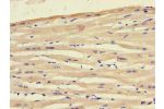 Immunohistochemistry of paraffin-embedded human heart tissue using CSB-PA836246LA01HU at dilution of 1:100