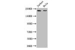 Western Blot<br />
Positive WB detected in:Jurkat whole cell lysate,Hela whole cell lysate<br />
All lanes: DOCK7 antibody at 3ug/ml<br />
Secondary<br />
Goat polyclonal to rabbit IgG at 1/50000 dilution<br />
Predicted band size: 243,242,239,73,240 kDa<