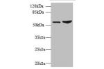 Western blot<br />
All lanes: FCRL4 antibody at 6ug/ml<br />
Lane 1 : 293T whole cell lysate<br />
Lane 2 : Mouse brain tissue<br />
Secondary<br />
Goat polyclonal to Rabbit IgG at 1/10000 dilution<br />
Predicted band size: 58,57 kDa<br />
Observed band