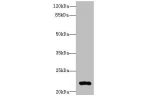 Western blot<br />
All lanes: ARL14 antibody at 0.3ug/ml+ MCF7 whole cell lysate<br />
Goat polyclonal to rabbit at 1/10000 dilution<br />
Predicted band size: 22 kDa<br />
Observed band size: 22 kDa<br />