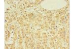 Immunohistochemistry of paraffin-embedded human adrenal gland tissue using CSB-PA836670LA01HU at dilution 1:100