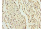 Immunohistochemistry of paraffin-embedded human lung tissue using CSB-PA836696ESR2HU at dilution 1:100