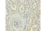 Immunohistochemistry of paraffin-embedded human kidney tissue using CSB-PA836734ESR1HU at dilution 1:100