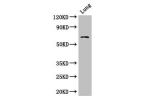 Western Blot<br />
Positive WB detected in:Mouse lung tissue<br />
All lanes: BBS1 antibody at 1ug/ml<br />
Secondary<br />
Goat polyclonal to rabbit IgG at 1/50000 dilution<br />
Predicted band size: 66,70,50 kDa<br />
Observed band size: 66 kDa<br />