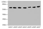 Western blot<br />
All lanes: ATL2 antibody at 1ug/ml<br />
Lane 1 : HepG-2 whole cell lysate<br />
Lane 2 : MCF7 whole cell lysate<br />
Lane 3 : HL60 whole cell lysate<br />
Lane 4 : K562 whole cell lysate<br />
Lane 5 : U251 whole cell lysate<br />
Lan