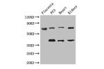 Western Blot<br />
Positive WB detected in:Human placenta tissue,PC3 whole cell lysate,Mouse heart tissue,Mouse kidney tissue<br />
All lanes: CEP70 antibody at 3.4ug/ml<br />
Secondary<br />
Goat polyclonal to rabbit IgG at 1/50000 dilution<br />
Predict