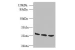 Western blot<br />
All lanes: DNAJB8 antibody at 8ug/ml<br />
Lane 1 : Hela whole cell lysate<br />
Lane 2 : Mouse brain tissue<br />
Lane 3 : Mouse liver tissue<br />
Secondary<br />
Goat polyclonal to Rabbit IgG at 1/10000 dilution<br />
Predicted band 