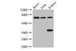 Western Blot<br />
Positive WB detected in:Mouse heart tissue,Mouse lung tissue,Mouse kidney tissue<br />
All lanes:BRSK1 antibody at 3.5ug/ml<br />
Secondary<br />
Goat polyclonal to rabbit IgG at 1/50000 dilution<br />
Predicted band size: 86,87,39 kDa<