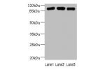 Western blot<br />
All lanes: ASAP3 antibody at 1ug/ml<br />
Lane 1 : A549 whole cell lysate<br />
Lane 2 : MCF7 whole cell lysate<br />
Lane 3 : K562 whole cell lysate<br />
Secondary<br />
Goat polyclonal to Rabbit IgG at 1/10000 dilution<br />
Predicte
