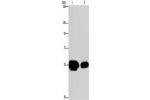 Gel: 8%SDS-PAGE, Lysate: 50 