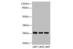 Western blot<br />
All lanes: C10orf82 antibody at 1ug/ml<br />
Lane 1 : A431 whole cell lysate<br />
Lane 2 : HepG-2 whole cell lysate<br />
Lane 3 : Mouse thymus tissue<br />
Secondary<br />
Goat polyclonal to Rabbit IgG at 1/10000 dilution<br />
Predic
