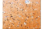 The image on the left is immunohistochemistry of paraffin-embedded Human brain tissue using CSB-PA838764(GDI1 Antibody) at dilution 1/20, on the right is treated with fusion protein. (Original magnification: 